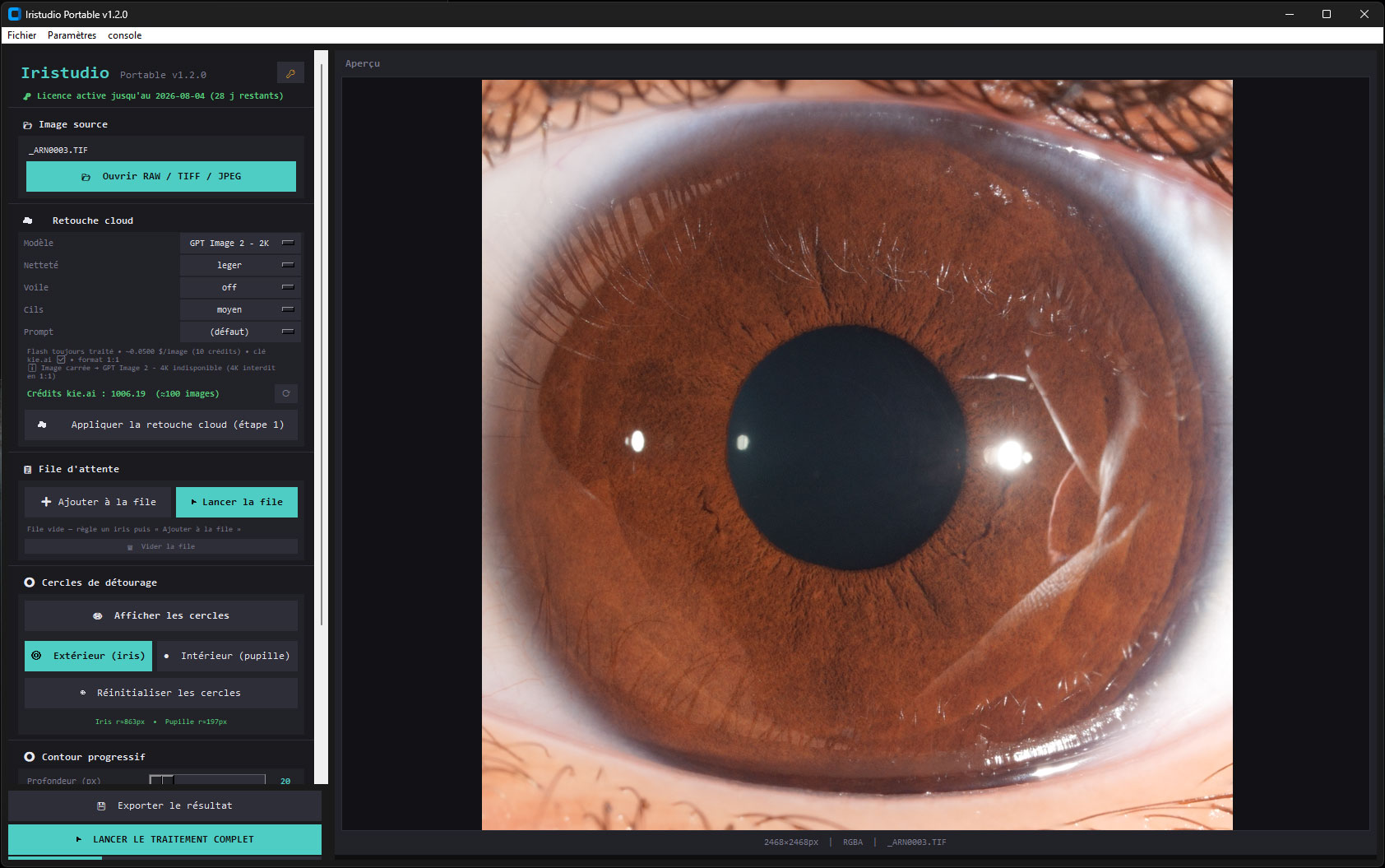 Iris avec reflets à nettoyer dans le logiciel